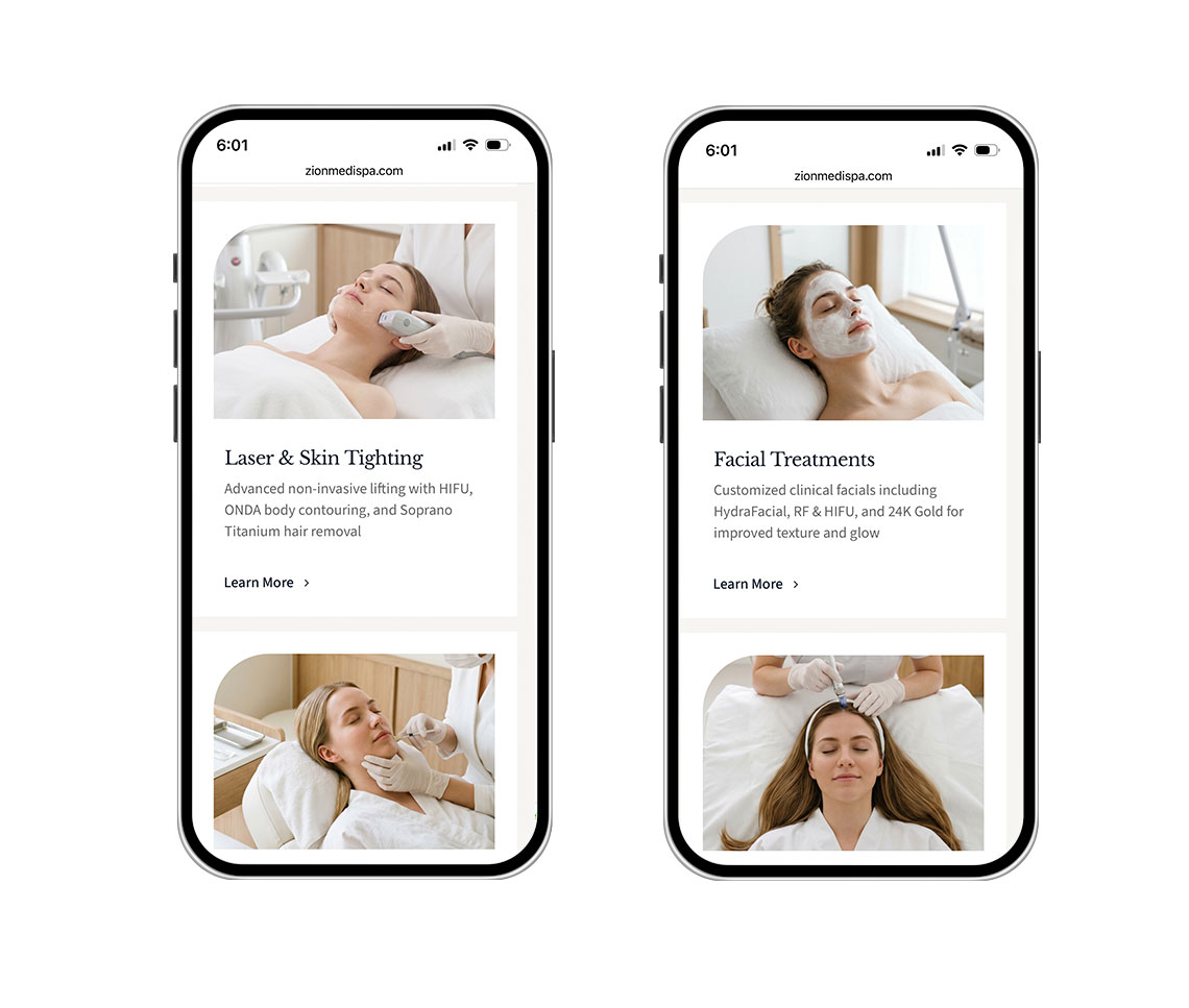 zionmedspa Two smartphones showing a spa services page with cards for Laser & Skin Tightening and Facial Treatments, including brief descriptions and Learn More links.