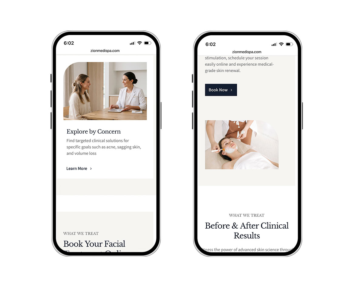 zionmedspa Mobile view of a spa website showing a consultation scene with two women at a table and an 'Explore by Concern' card next to it.